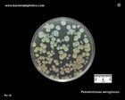 pseudomonas aeruginosa pigmentation